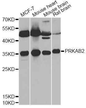 PRKAB2 / AMPK Beta 2 Antibody - Western blot analysis of extracts of various cell lines, using PRKAB2 antibody at 1:1000 dilution. The secondary antibody used was an HRP Goat Anti-Rabbit IgG (H+L) at 1:10000 dilution. Lysates were loaded 25ug per lane and 3% nonfat dry milk in TBST was used for blocking. An ECL Kit was used for detection and the exposure time was 90s.