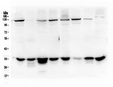 PRKAB2 / AMPK Beta 2 Antibody - Western blot analysis of AMPK beta 2 using anti-AMPK beta 2 antibody. Electrophoresis was performed on a 10% SDS-PAGE gel at 70V (Stacking gel) / 90V (Resolving gel) for 2-3 hours. The sample well of each lane was loaded with 50ug of sample under reducing conditions. Lane 1: human Hela whole cell lysate, Lane 2: human placenta tissue lysate,Lane 3: human 293T whole cell lysate,Lane 4: human A549 whole cell lysate,Lane 5: human A375 whole cell lysate,Lane 6: human A431 whole cell lysate,Lane 7: human U20S whole cell lysate,Lane 8: human K562 whole cell lysate. After Electrophoresis, proteins were transferred to a Nitrocellulose membrane at 150mA for 50-90 minutes. Blocked the membrane with 5% Non-fat Milk/ TBS for 1.5 hour at RT. The membrane was incubated with mouse anti-AMPK beta 2 antigen affinity purified monoclonal antibody at 0.5 µg/mL overnight at 4°C, then washed with TBS-0.1% Tween 3 times with 5 minutes each and probed with a goat anti-mouse IgG-HRP secondary antibody at a dilution of 1:10000 for 1.5 hour at RT. The signal is developed using an Enhanced Chemiluminescent detection (ECL) kit with Tanon 5200 system.