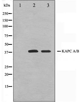 PRKACA Antibody - Western blot analysis on Jurkat and K562 cell lysates using KAPC A/B antibody. The lane on the left is treated with the antigen-specific peptide.
