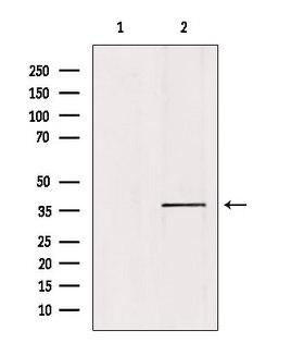 PRKACA Antibody - Western blot analysis of extracts of mouse brain tissue using KAPC A/B antibody. Lane 1 was treated with the blocking peptide.