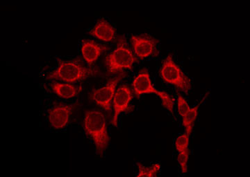 PRKACA Antibody - Staining HeLa cells by IF/ICC. The samples were fixed with PFA and permeabilized in 0.1% Triton X-100, then blocked in 10% serum for 45 min at 25°C. The primary antibody was diluted at 1:200 and incubated with the sample for 1 hour at 37°C. An Alexa Fluor 594 conjugated goat anti-rabbit IgG (H+L) Ab, diluted at 1/600, was used as the secondary antibody.