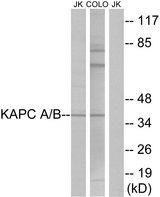 PRKACA Antibody - Western blot analysis of extracts from Jurkat cells and COLO cells, using KAPC A/B antibody.