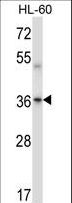 PRKACA + PRKACB Antibody - Mouse Prkaca/Prkacb Antibody western blot of HL-60 cell line lysates (35 ug/lane). The Prkaca/Prkacb antibody detected the Prkaca/Prkacb protein (arrow).