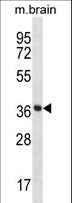 PRKACA + PRKACB Antibody - Mouse Prkaca/Prkacb Antibody western blot of mouse brain tissue lysates (35 ug/lane). The Prkaca/Prkacb antibody detected the Prkaca/Prkacb protein (arrow).