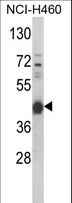 PRKACA + PRKACB Antibody - Western blot of PRKACA Antibody (N-term K82) in NCI-H460 cell line lysates (35 ug/lane). PRKACA (arrow) was detected using the purified antibody.