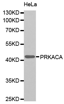 PRKACA + PRKACB Antibody - Western blot analysis of extracts of HeLa cells, using PRKACA antibody. The secondary antibody used was an HRP Goat Anti-Rabbit IgG (H+L) at 1:10000 dilution. Lysates were loaded 25ug per lane and 3% nonfat dry milk in TBST was used for blocking.