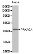 PRKACA + PRKACB Antibody - Western blot analysis of extracts of HeLa cells, using PRKACA antibody. The secondary antibody used was an HRP Goat Anti-Rabbit IgG (H+L) at 1:10000 dilution. Lysates were loaded 25ug per lane and 3% nonfat dry milk in TBST was used for blocking.