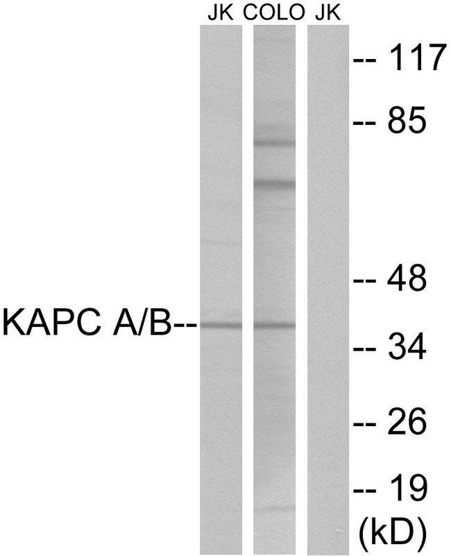 PRKACA + PRKACB Antibody - Western blot analysis of lysates from COLO and Jurkat cells, using KAPC A/B Antibody. The lane on the right is blocked with the synthesized peptide.
