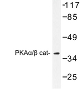 PRKACA + PRKACB Antibody - Western blot of PKA antibody in extracts from COLO cells.