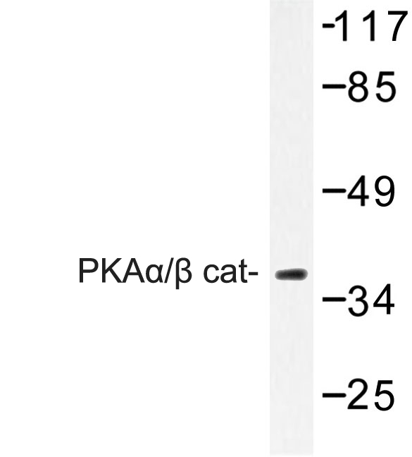 PRKACA + PRKACB Antibody - Western blot of PKA antibody in extracts from COLO cells.