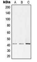PRKACA + PRKACB Antibody - Western blot analysis of PKA C alpha/beta expression in HEK293T (A); Raw264.7 (B); PC12 (C) whole cell lysates.