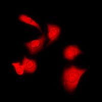 PRKACA + PRKACB Antibody - Immunofluorescent analysis of PKA C alpha/beta staining in Raw264.7 cells. Formalin-fixed cells were permeabilized with 0.1% Triton X-100 in TBS for 5-10 minutes and blocked with 3% BSA-PBS for 30 minutes at room temperature. Cells were probed with the primary antibody in 3% BSA-PBS and incubated overnight at 4 C in a humidified chamber. Cells were washed with PBST and incubated with a DyLight 594-conjugated secondary antibody (red) in PBS at room temperature in the dark. DAPI was used to stain the cell nuclei (blue).