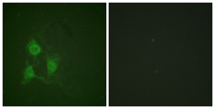 PRKACA + PRKACB Antibody - Immunofluorescence analysis of A549 cells, using PKA CAT (Phospho-Thr197) Antibody. The picture on the right is blocked with the phospho peptide.