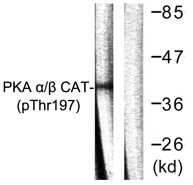 PRKACA + PRKACB Antibody - Western blot analysis of lysates from mouse brain, using PKA CAT (Phospho-Thr197) Antibody. The lane on the right is blocked with the phospho peptide.