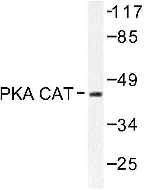 PRKACA + PRKACB Antibody - Western blot of PKACa (V191) pAb in extracts from mouse brain.