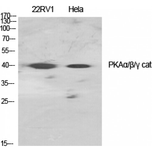 PRKACA + PRKACB + PRKACG Antibody - Western blot of PKA alpha/beta/gamma cat antibody