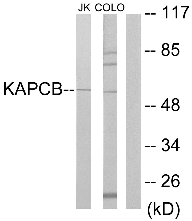 PRKACB Antibody - Western blot analysis of lysates from Jurkat and COLO205 cells, using KAPCB Antibody. The lane on the right is blocked with the synthesized peptide.