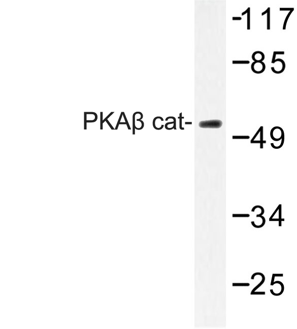 PRKACB Antibody - Western blot of PKA beta antibody in extracts from COLO205 cells.