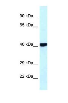 PRKACB Antibody - PRKACB antibody Western blot of Fetal Heart lysate. Antibody concentration 1 ug/ml. This image was taken for the unconjugated form of this product. Other forms have not been tested.