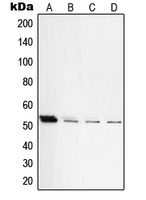PRKACB Antibody - Western blot analysis of PKA C beta expression in HEK293T (A); NIH3T3 (B); mouse lung (C); rat lung (D) whole cell lysates.