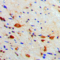 PRKACB Antibody - Immunohistochemical analysis of PKA C beta staining in human brain formalin fixed paraffin embedded tissue section. The section was pre-treated using heat mediated antigen retrieval with sodium citrate buffer (pH 6.0). The section was then incubated with the antibody at room temperature and detected using an HRP conjugated compact polymer system. DAB was used as the chromogen. The section was then counterstained with hematoxylin and mounted with DPX.