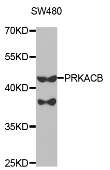 PRKACB Antibody - Western blot analysis of extracts of SW480 cell line, using PRKACB antibody.