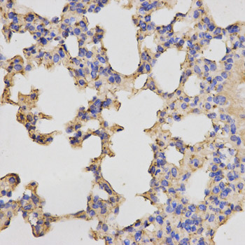 PRKACB Antibody - Immunohistochemistry of paraffin-embedded mouse lung using PRKACB antibody at dilution of 1:200 (x400 lens)