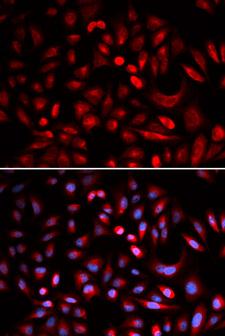 PRKACB Antibody - Immunofluorescence analysis of U2OS cell using PRKACB antibody. Blue: DAPI for nuclear staining.