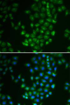 PRKACB Antibody - Immunofluorescence analysis of U2OS cells.