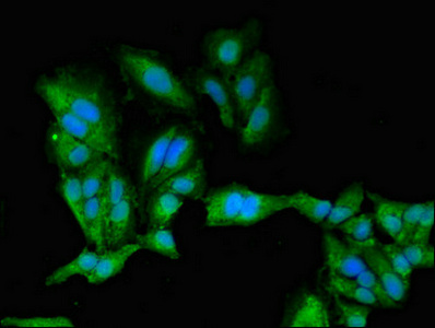 PRKACB Antibody - Immunofluorescent analysis of Hela cells diluted at 1:100 and Alexa Fluor 488-congugated AffiniPure Goat Anti-Rabbit IgG(H+L)