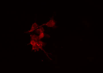 PRKACB Antibody - Staining HeLa cells by IF/ICC. The samples were fixed with PFA and permeabilized in 0.1% Triton X-100, then blocked in 10% serum for 45 min at 25°C. The primary antibody was diluted at 1:200 and incubated with the sample for 1 hour at 37°C. An Alexa Fluor 594 conjugated goat anti-rabbit IgG (H+L) antibody, diluted at 1/600, was used as secondary antibody.