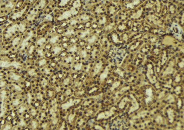 PRKACB Antibody - 1:100 staining mouse kidney tissue by IHC-P. The sample was formaldehyde fixed and a heat mediated antigen retrieval step in citrate buffer was performed. The sample was then blocked and incubated with the antibody for 1.5 hours at 22°C. An HRP conjugated goat anti-rabbit antibody was used as the secondary.