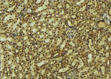 PRKACB Antibody - 1:100 staining mouse kidney tissue by IHC-P. The sample was formaldehyde fixed and a heat mediated antigen retrieval step in citrate buffer was performed. The sample was then blocked and incubated with the antibody for 1.5 hours at 22°C. An HRP conjugated goat anti-rabbit antibody was used as the secondary.