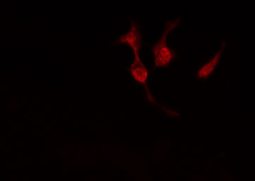 PRKACB Antibody - Staining HeLa cells by IF/ICC. The samples were fixed with PFA and permeabilized in 0.1% Triton X-100, then blocked in 10% serum for 45 min at 25°C. The primary antibody was diluted at 1:200 and incubated with the sample for 1 hour at 37°C. An Alexa Fluor 594 conjugated goat anti-rabbit IgG (H+L) antibody, diluted at 1/600, was used as secondary antibody.