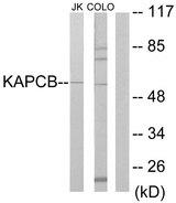 PRKACB Antibody - Western blot analysis of extracts from Jurkat cells and COLO205 cells, using KAPCB antibody.