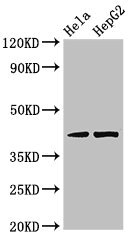 PRKACG Antibody - Western Blot Positive WB detected in: Hela whole cell lysate, HepG2 whole cell lysate All lanes: PRKACG antibody at 3.2µg/ml Secondary Goat polyclonal to rabbit IgG at 1/50000 dilution Predicted band size: 41 kDa Observed band size: 41 kDa