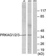 PRKAG1+2+3 Antibody - Western blot analysis of extracts from Jurkat cells and 293 cells, using PRKAG1/2/3 antibody.