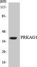 PRKAG1 / AMPK Gamma 1 Antibody - Western blot analysis of the lysates from HT-29 cells using PRKAG1 antibody.