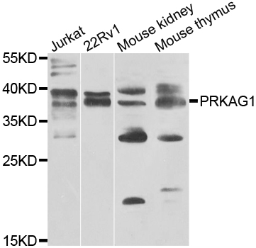 PRKAG1 / AMPK Gamma 1 Antibody - Western blot analysis of extracts of various cell lines.