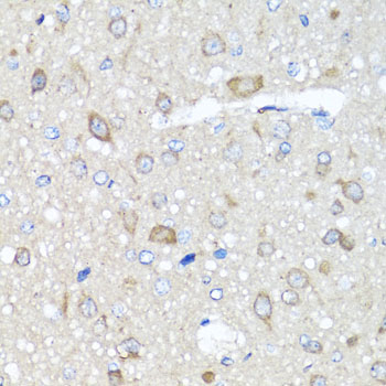 PRKAG1 / AMPK Gamma 1 Antibody - Immunohistochemistry of paraffin-embedded rat brain tissue.