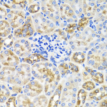 PRKAG1 / AMPK Gamma 1 Antibody - Immunohistochemistry of paraffin-embedded mouse kidney tissue.