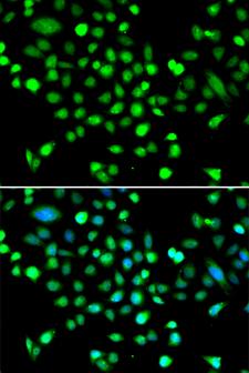 PRKAG1 / AMPK Gamma 1 Antibody - Immunofluorescence analysis of MCF7 cells.