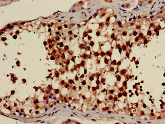 PRKAG1 / AMPK Gamma 1 Antibody - Immunohistochemistry of paraffin-embedded human testis tissue at dilution of 1:100