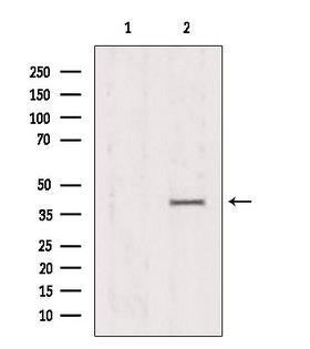 PRKAG1 / AMPK Gamma 1 Antibody - Western blot analysis of extracts of HeLa cells using PRKAG1/2/3 antibody. Lane 1 was treated with the antigen-specific peptide.