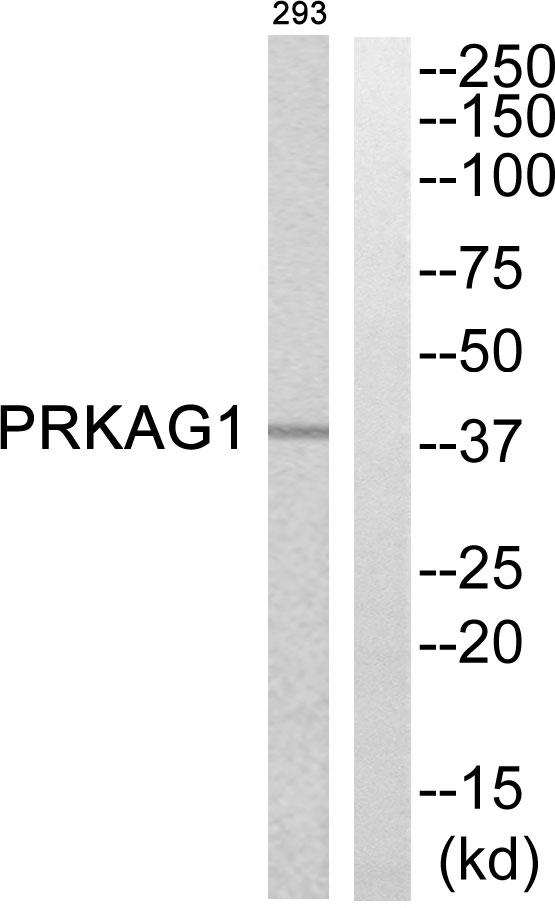 PRKAG1 / AMPK Gamma 1 Antibody - Western blot analysis of extracts from 293 cells, using PRKAG1 antibody.