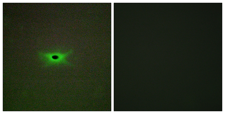 PRKAG2 / AMPK Gamma 2 Antibody - Immunofluorescence analysis of A549 cells, using PRKAG2 Antibody. The picture on the right is blocked with the synthesized peptide.