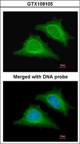 PRKAG2 / AMPK Gamma 2 Antibody - Immunofluorescence of paraformaldehyde-fixed HeLa using AMPK gamma-2 antibody at 1:200 dilution.