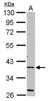 PRKAG2 / AMPK Gamma 2 Antibody - Sample (50 ug of whole cell lysate). A: Mouse brain. 10% SDS PAGE. AAMPK Gamma 2 / PRKAG2 antibody diluted at 1:1000.