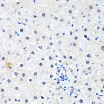 PRKAG2 / AMPK Gamma 2 Antibody - Immunohistochemistry of paraffin-embedded Rat liver using PRKAG2 Polyclonal Antibody at dilution of 1:100 (40x lens).