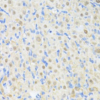 PRKAG2 / AMPK Gamma 2 Antibody - Immunohistochemistry of paraffin-embedded Rat ovary using PRKAG2 Polyclonal Antibody at dilution of 1:100 (40x lens).